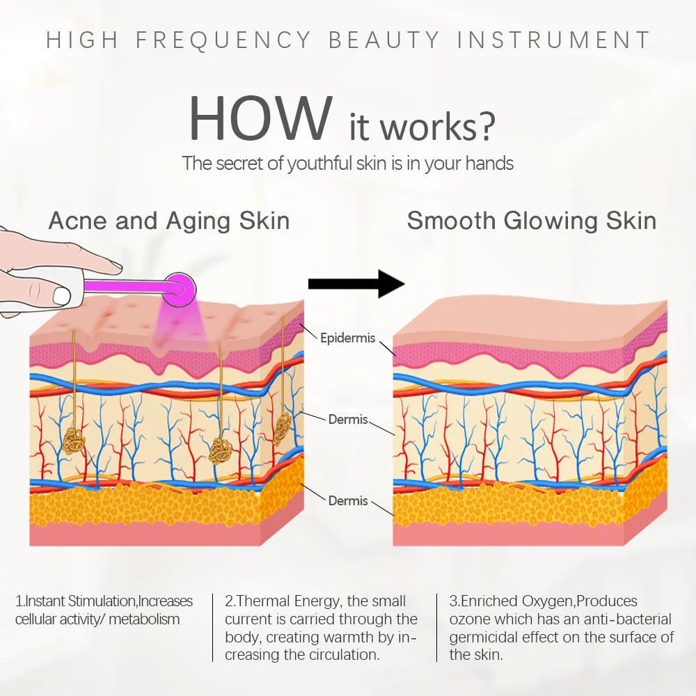 LZ006A High Frequency Wand &ndash; Skin Tightening And Acne Care