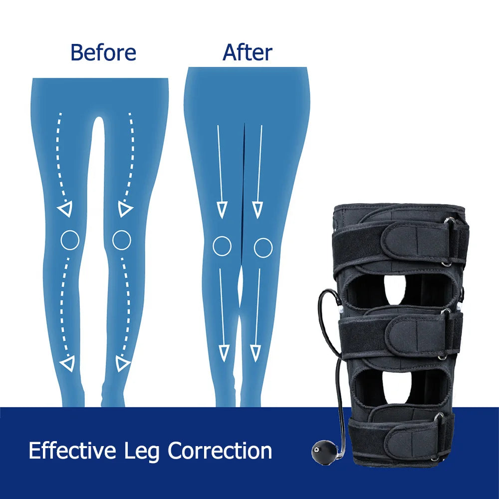 OX Legs Orthotic Corrector &ndash; Leg Straightening Support