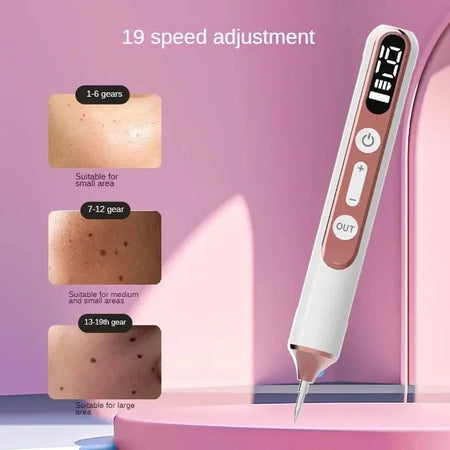 Skin Tag Remover Laser Plasma Pen &ndash; Warts Eliminator