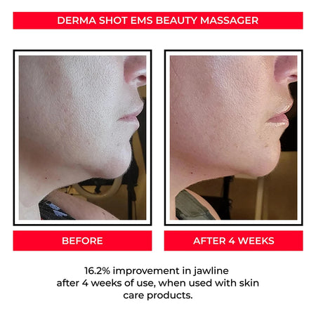 Muscle Ball Massage 3D Sculptor &ndash; Skin Tightening and Rejuvenation