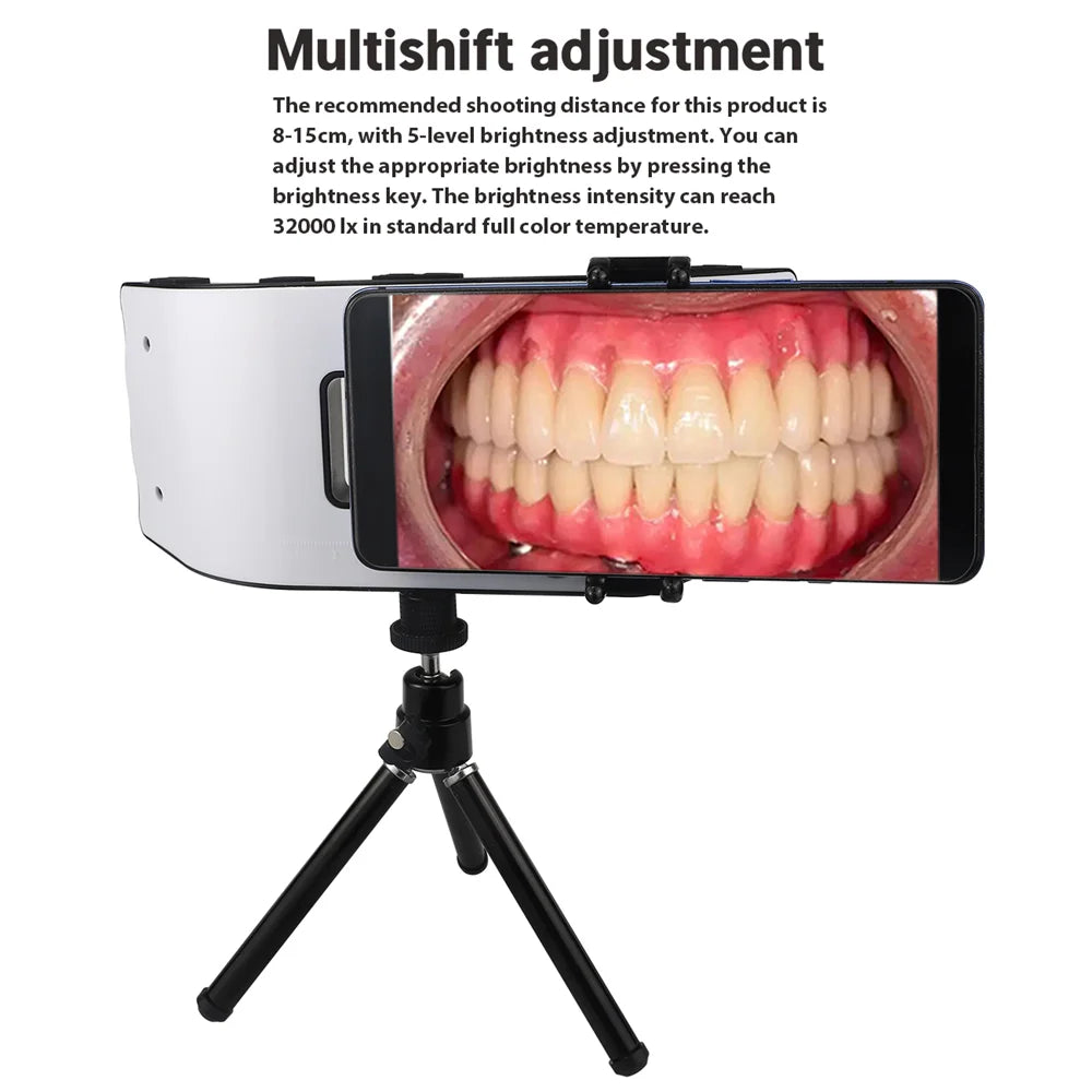 Dental Photography Oral Filling Lamp &ndash; Intraoral Lighting