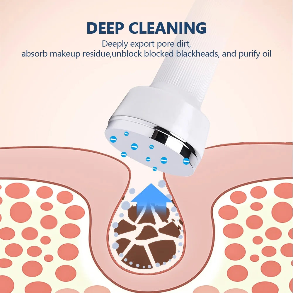 3 IN 1 Ultrasound Beauty Machine &ndash; Skin Tightening and Pore Cleansing