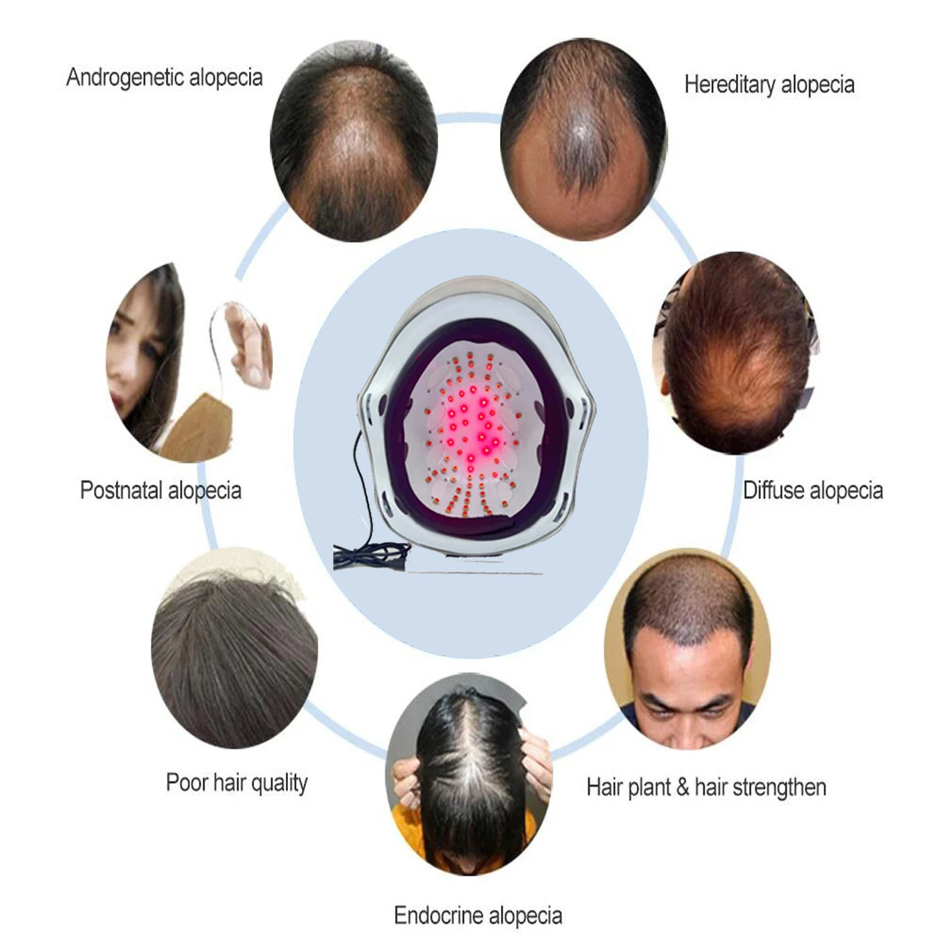 Hair Growth Cap Laser Helmet &ndash; Infrared Light Therapy