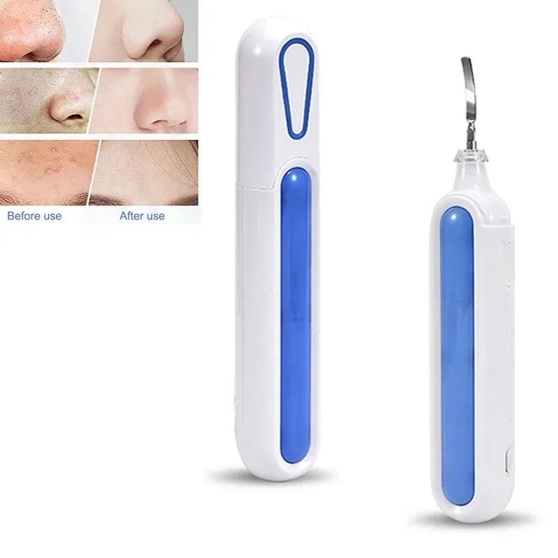 Portable Pore Cleansing Skin Scrubber &ndash; Ultrasonic Cleaning