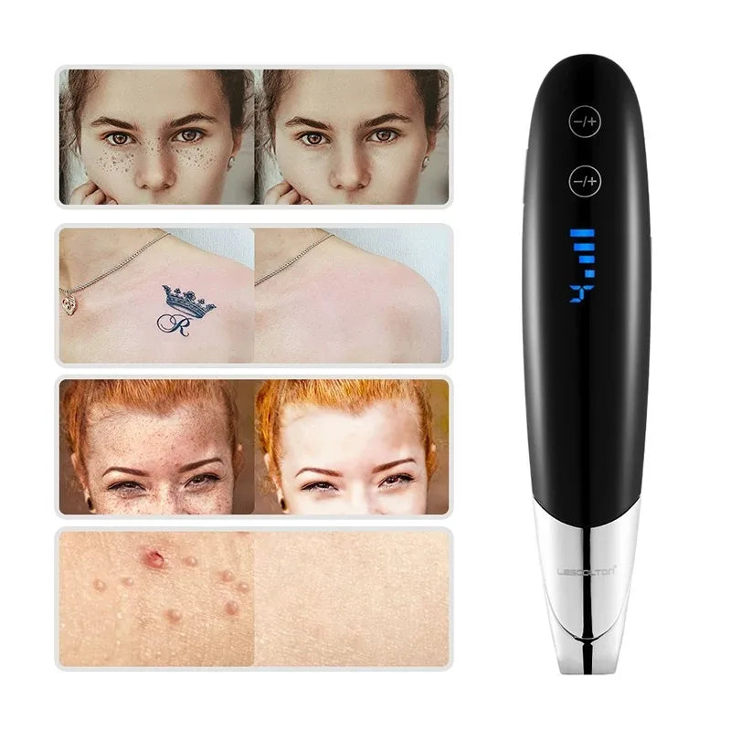 9 Level Laser Picosecond Pen &ndash; All In One Skin Rejuvenation