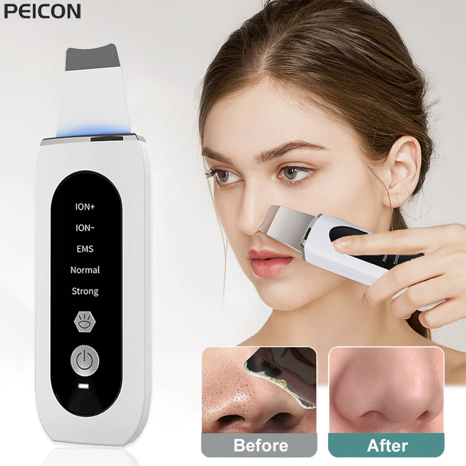 Ultrasonic Skin Scrubber Facial Cleanser for Deep Pore Cleansing and Exfoliation