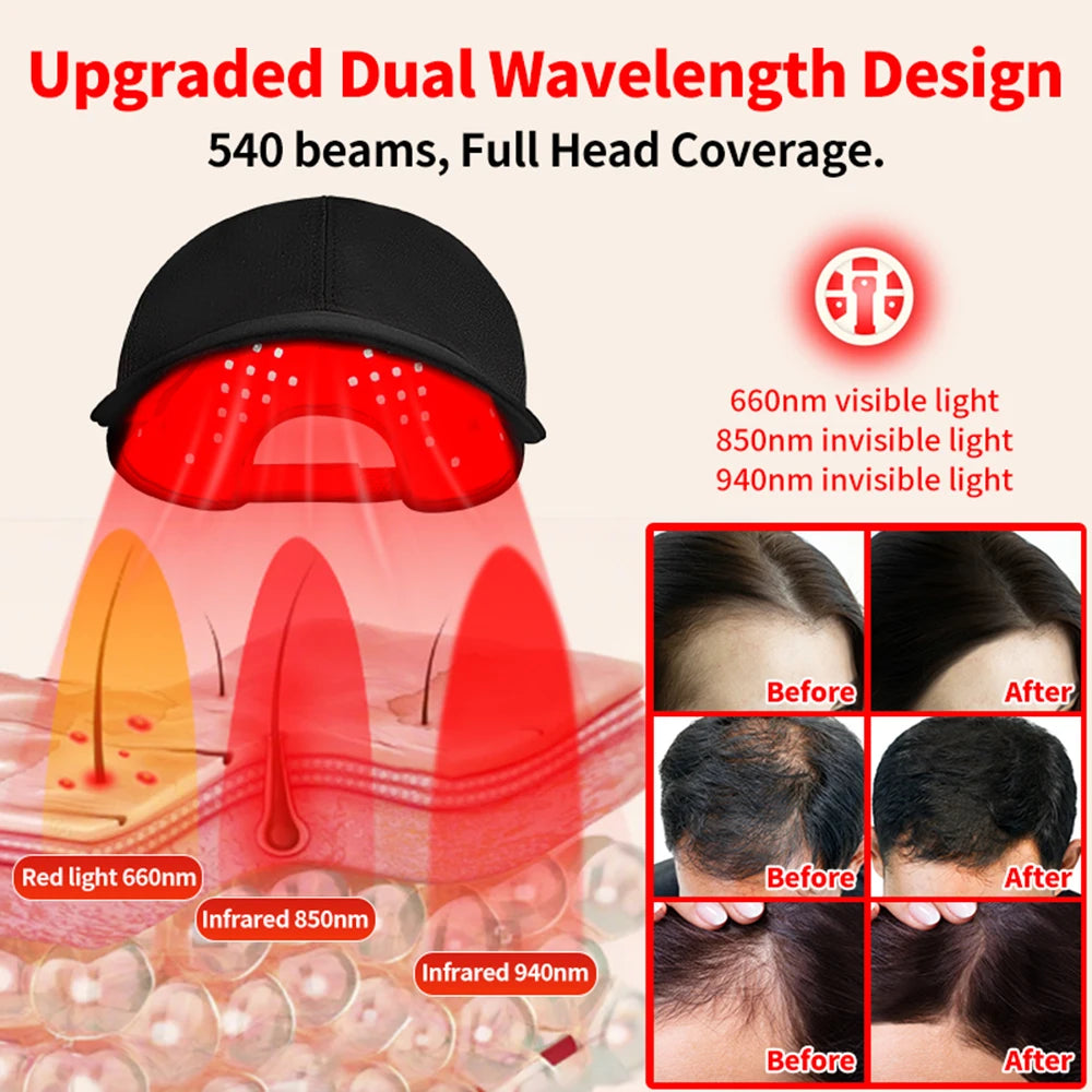 Red Light Therapy Hat Infrared 180LED Helmet - Hair Growth