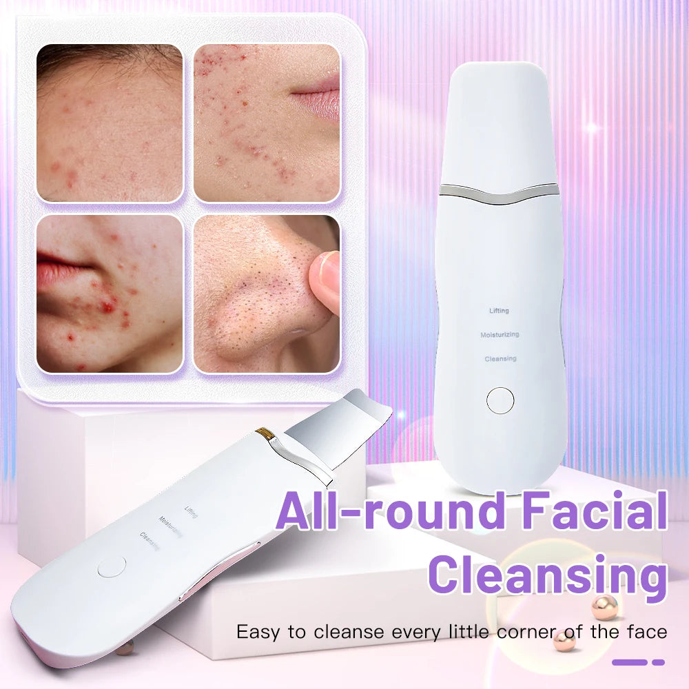 Electric Ultrasonic Skin Scrubber - Blackhead Remover &amp; Facial Lifting Tool