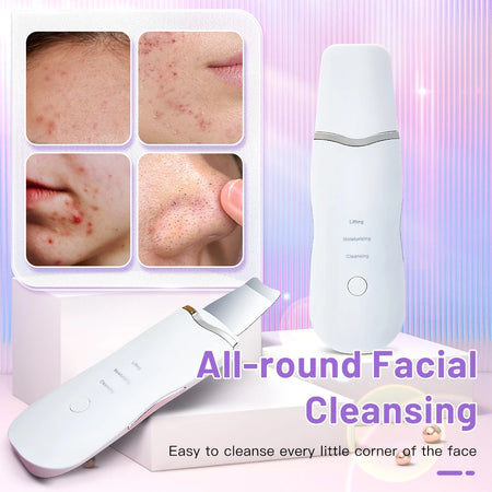 Electric Ultrasonic Skin Scrubber - Blackhead Remover &amp; Facial Lifting Tool