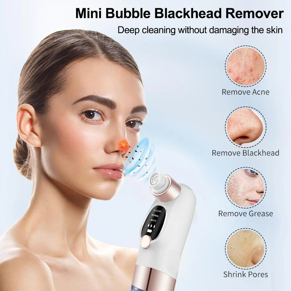 Electric Blackhead Remover Pore Cleaner, Acne Extractor for Clear Skin