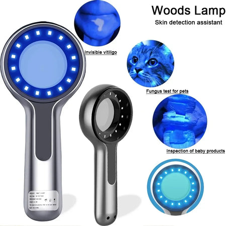 Woods Lamp Skin Analyzer &ndash; UV Skin Analysis Device