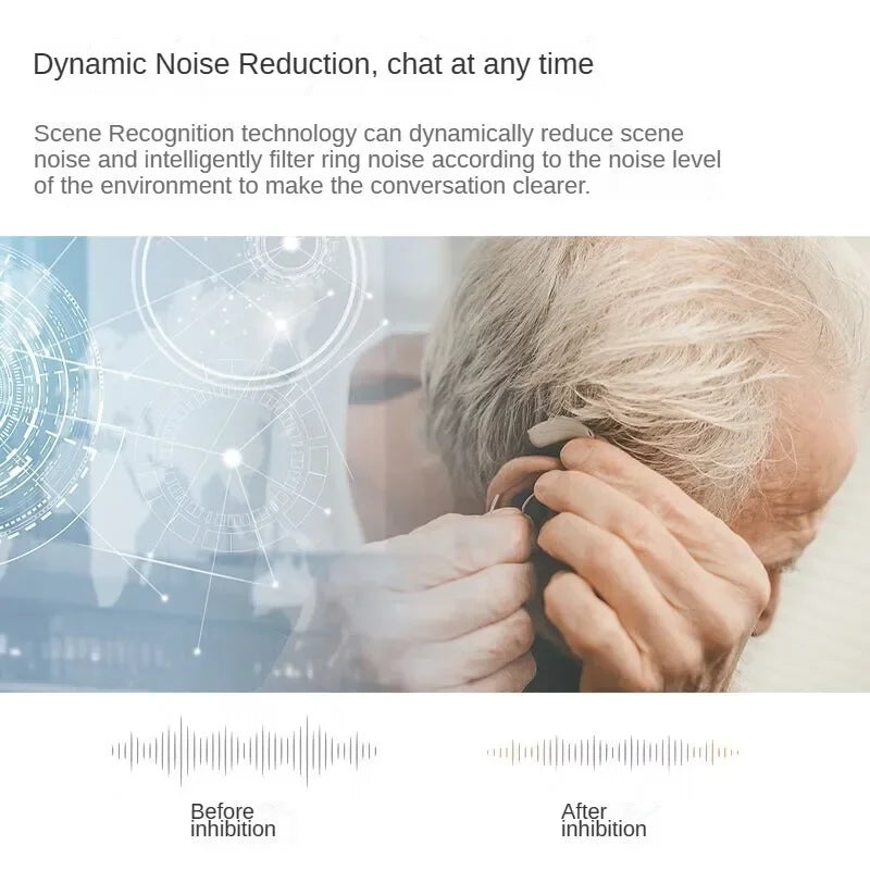 Oticon Jet Hearing Aid: High-Resolution Sound with Bluetooth Streaming