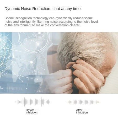 Oticon Jet Hearing Aid: High-Resolution Sound with Bluetooth Streaming