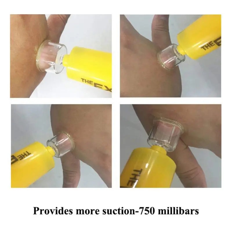 Survivor Venom Extractor Kit: Portable First Aid for Snake and Insect Bites