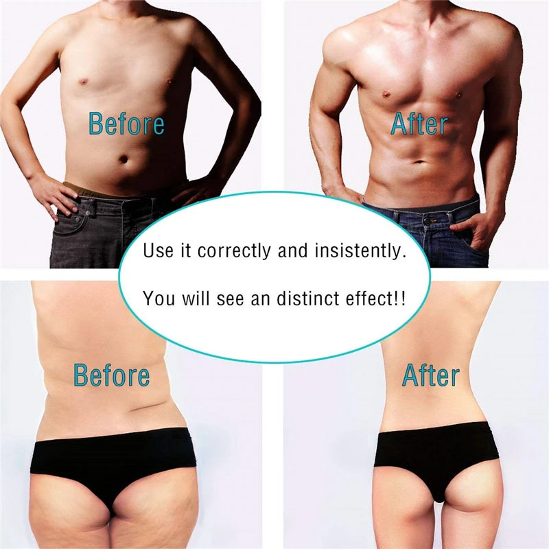 UPUPDay Electric Muscle Stimulator: Abs Stimulator &amp;amp; Body Toner Machine
